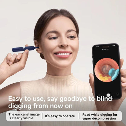 EarVue™ Smart Visual Ear Cleaner